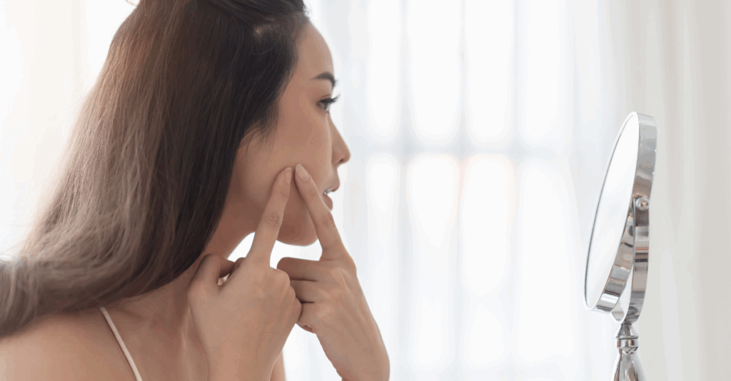 Tackling Acne by Balancing Blood Sugar and Hormones