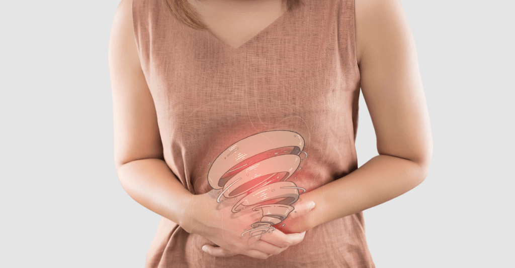 Gut Health Strategies for IBD Flares