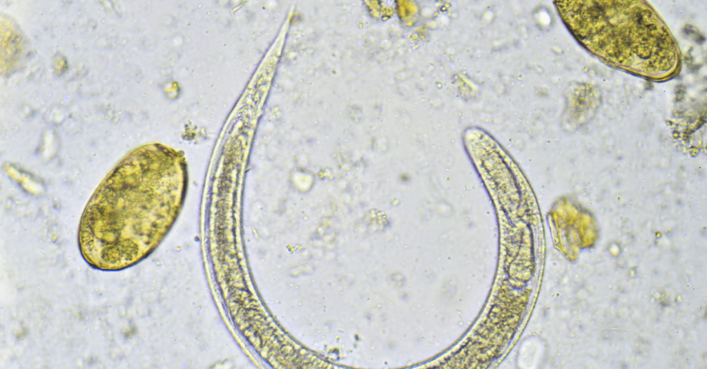 What You Need To Know About Parasites
